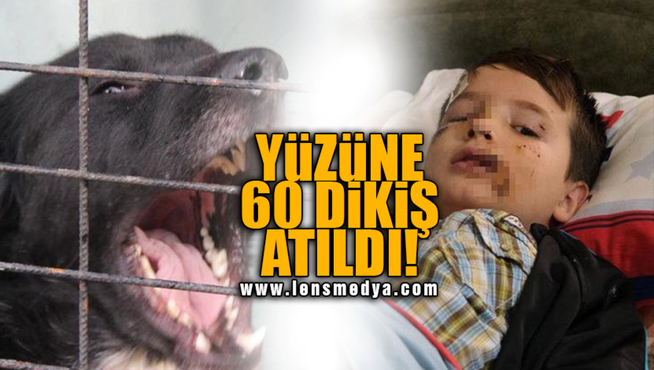 YÜZÜNE 60 DİKİŞ ATILDI!