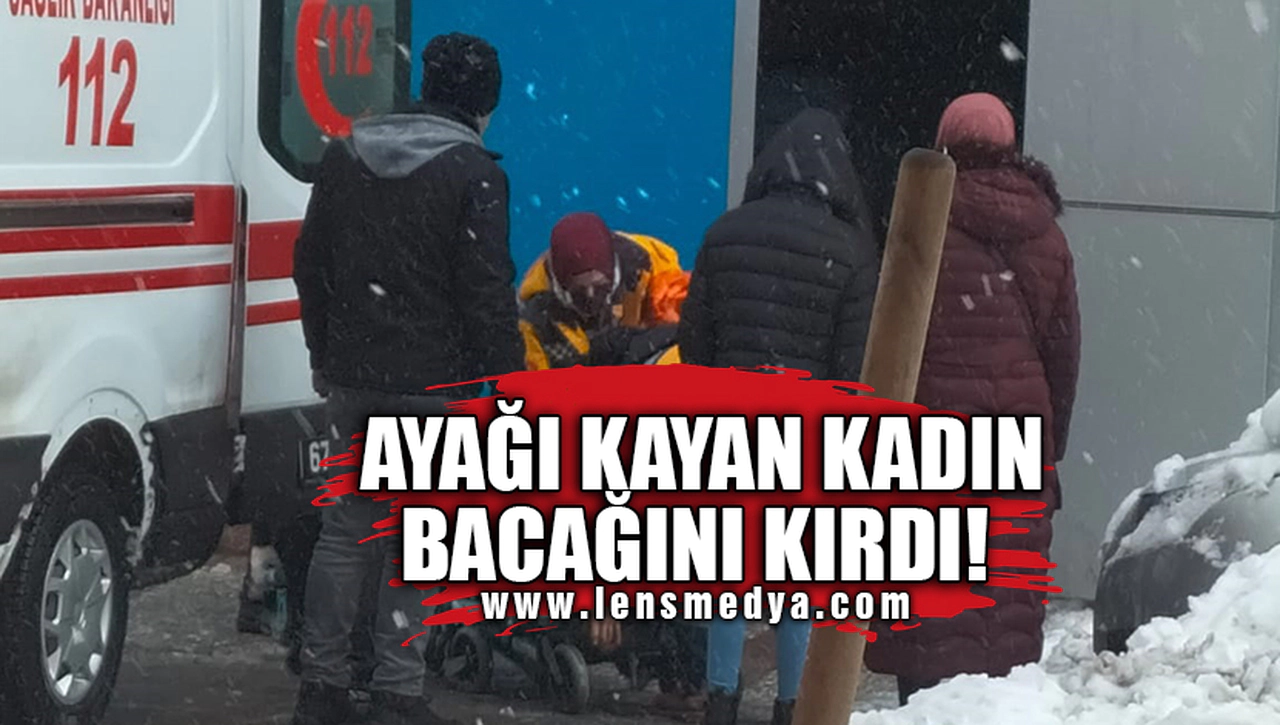 AYAĞI KAYAN KADIN BACAĞINI KIRDI!