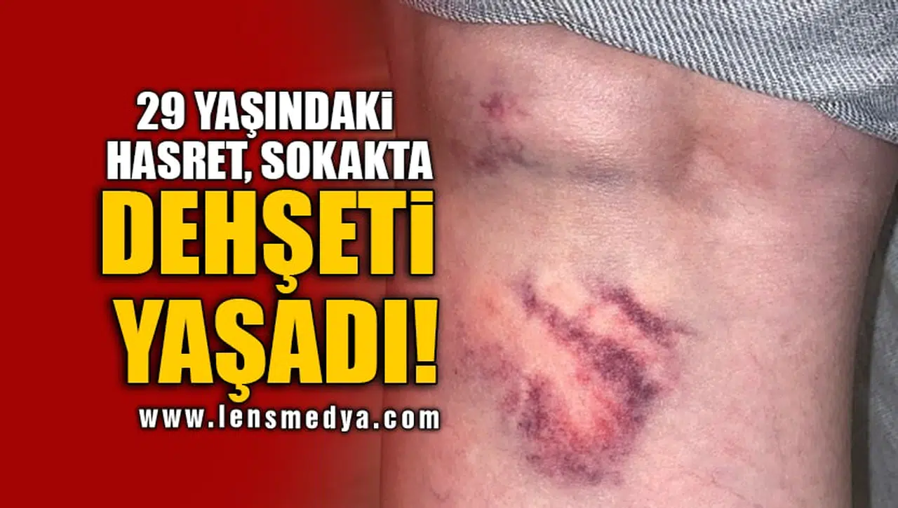 29 YAŞINDAKİ HASRET, SOKAKTA DEHŞETİ YAŞADI!