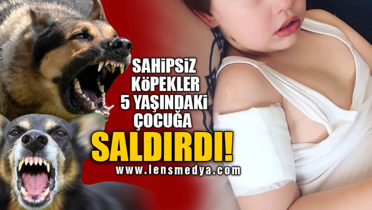 SAHİPSİZ KÖPEKLER 5 YAŞINDAKİ ÇOCUĞA SALDIRDI!