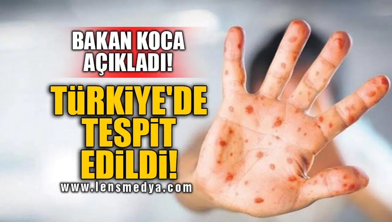 TÜRKİYE'DE TESPİT EDİLDİ!
