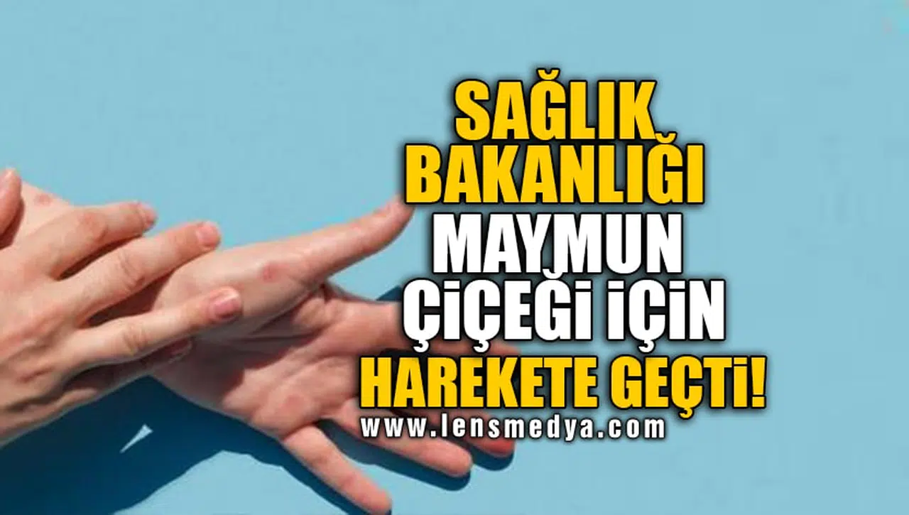 SAĞLIK BAKANLIĞI MAYMUN ÇİÇEĞİ İÇİN HAREKETE GEÇTİ!