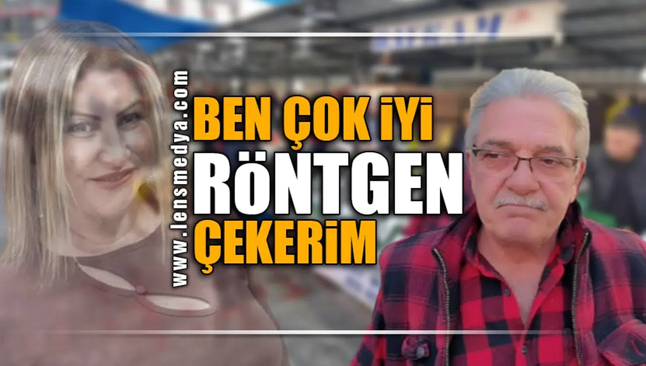 "BEN ÇOK İYİ RÖNTGEN ÇEKERİM"