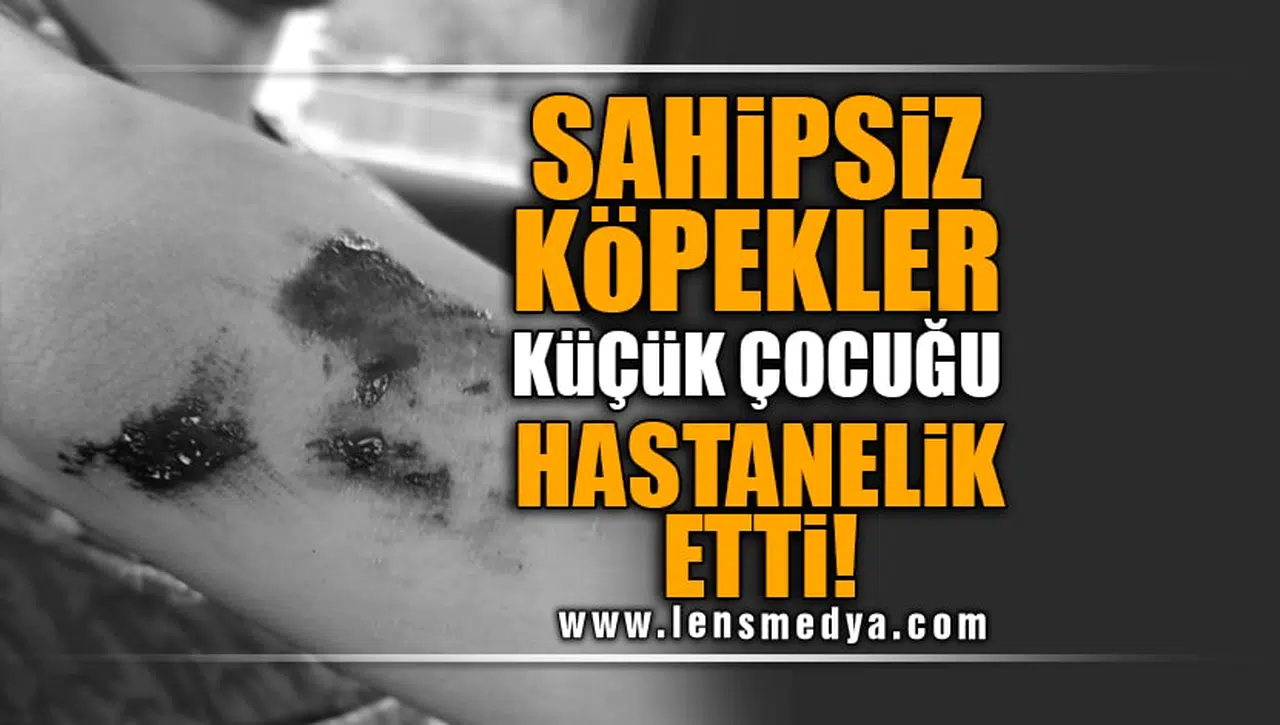 SAHİPSİZ KÖPEKLER KÜÇÜK ÇOCUĞU HASTANELİK ETTİ!
