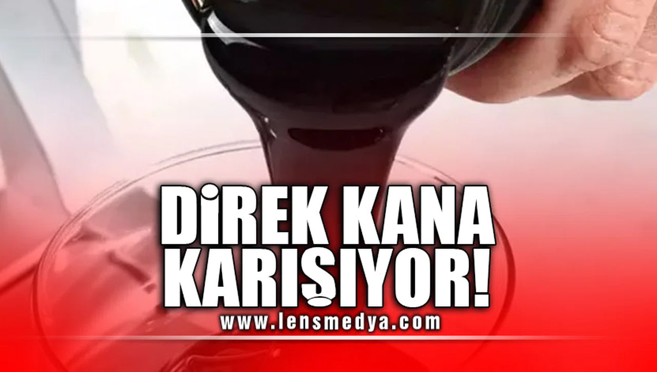 DİREK KANA KARIŞIYOR!