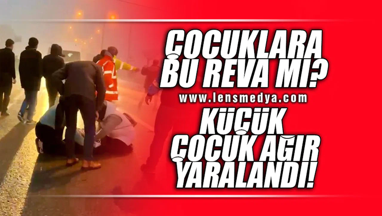 ÇOCUKLARA BU REVA MI? KÜÇÜK ÇOCUK AĞIR YARALANDI!