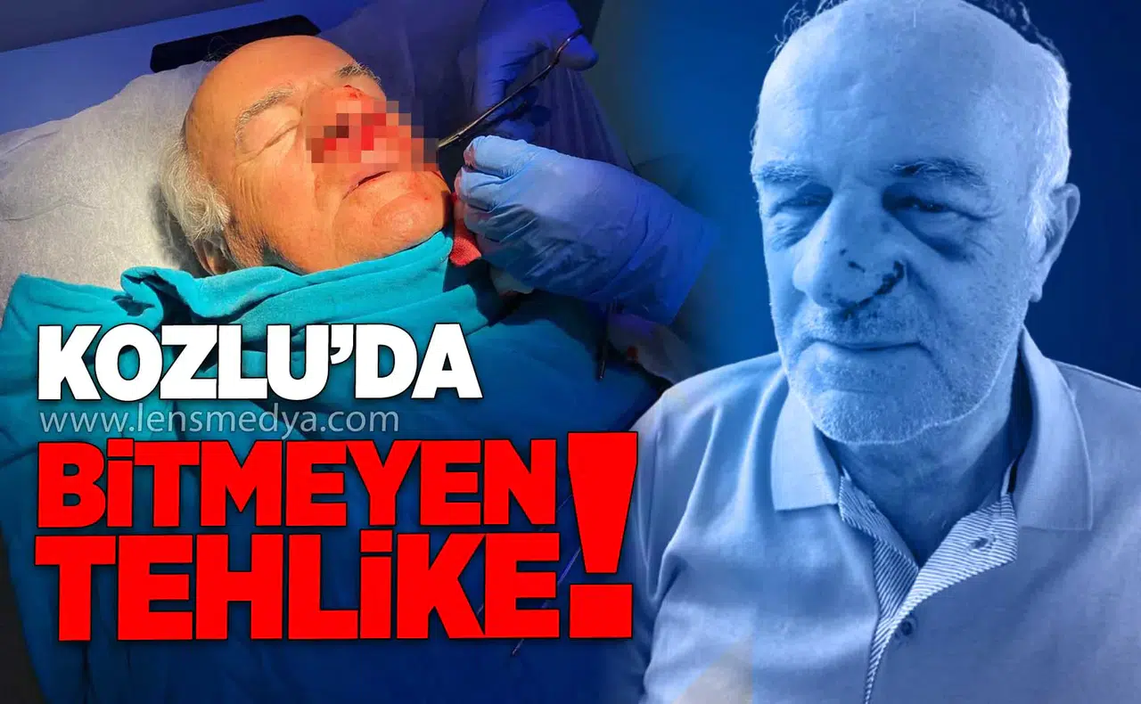 72 yaşındaki vatandaş hastanelik oldu