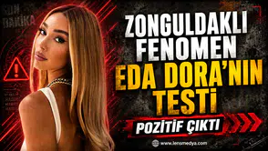 Eda Dora'nın testi poztif çıktı!