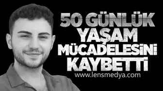 Acı Son: 50 Günlük Yaşam Mücadelesini Kaybetti