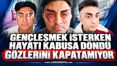 Gençleşmek isterken hayatı kabusa döndü: Gözlerini kapatamıyor