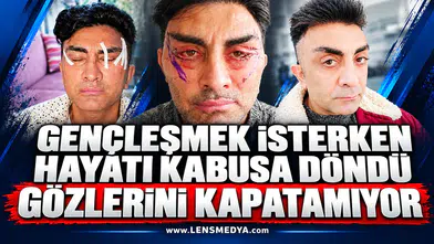 Gençleşmek isterken hayatı kabusa döndü: Gözlerini kapatamıyor