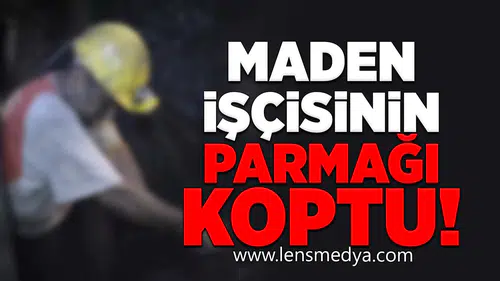 Madencinin Parmağı Koptu!