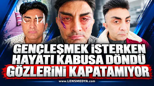 Gençleşmek isterken hayatı kabusa döndü: Gözlerini kapatamıyor