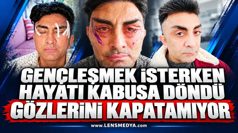 Gençleşmek isterken hayatı kabusa döndü: Gözlerini kapatamıyor